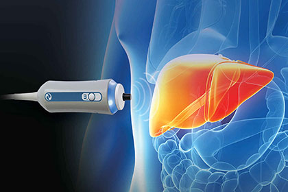 vor Fibroscan